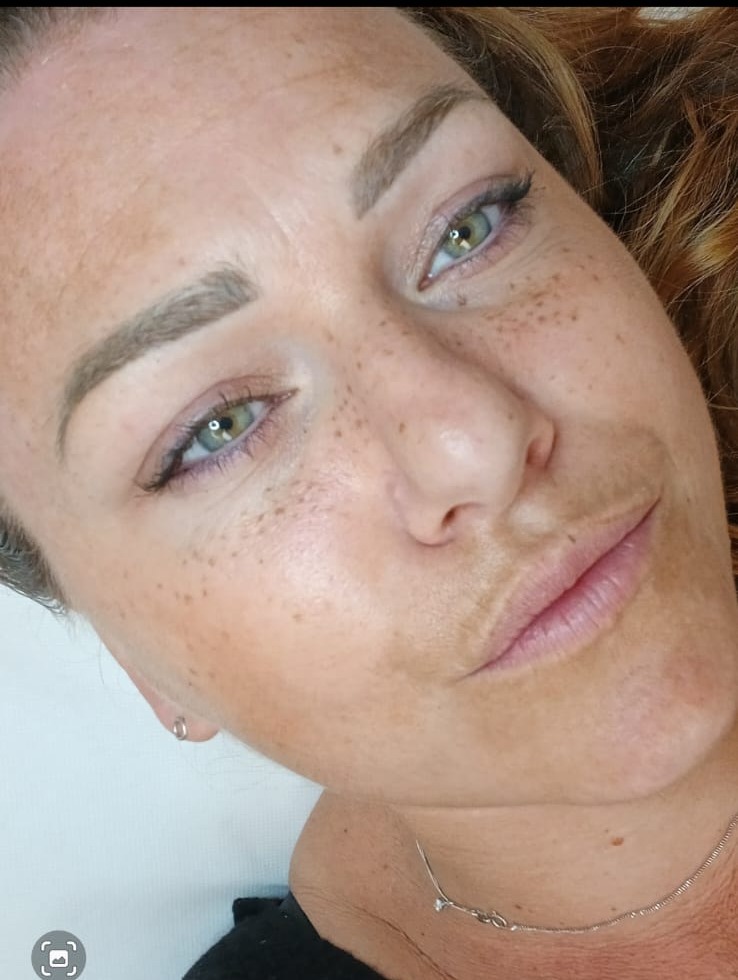 Exemple de maquillage permanent : taches de rousseur
